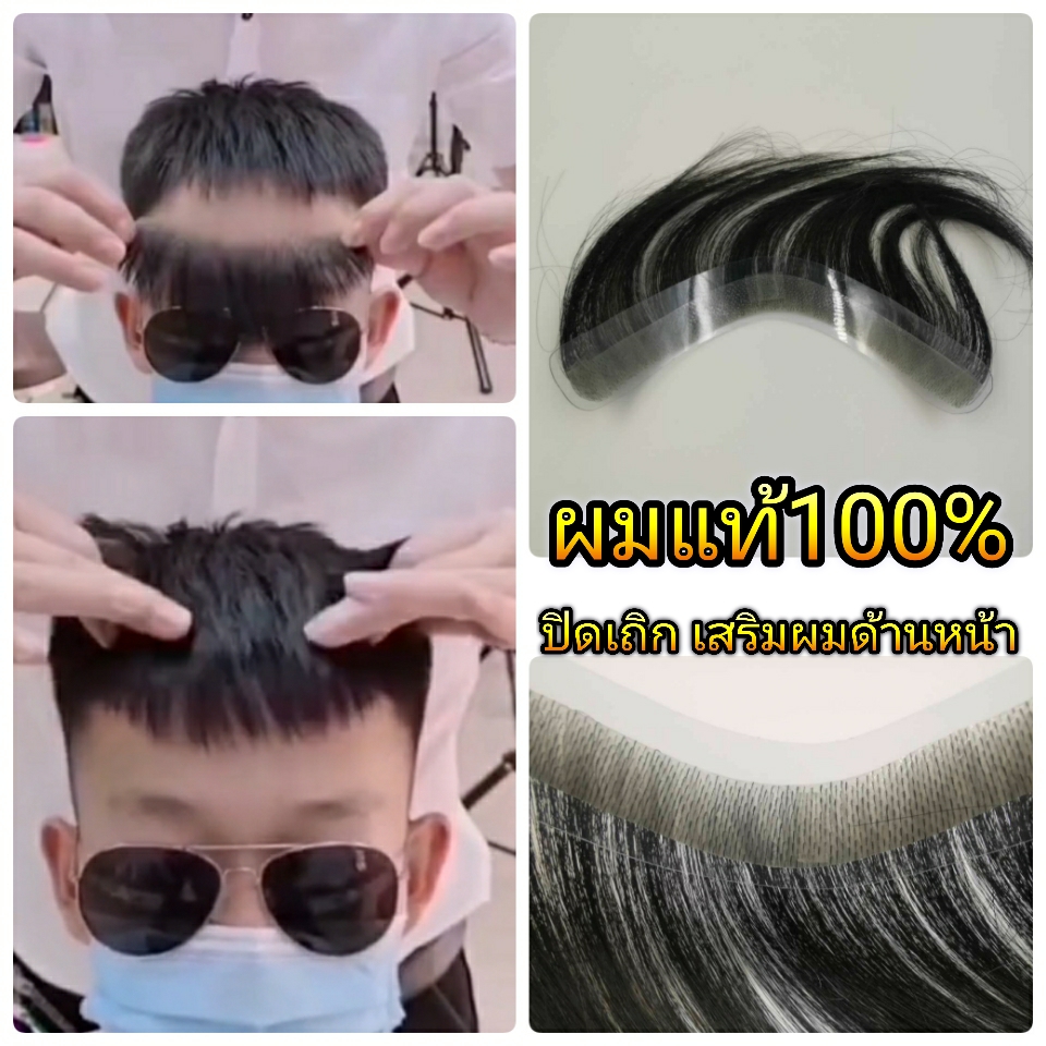 วิกติดกาวผู้ชาย แผ่นปิดหัวเถิก หน้าผากกว้าง ผมแท้100% ไม่ต้องโกนผมเดิม