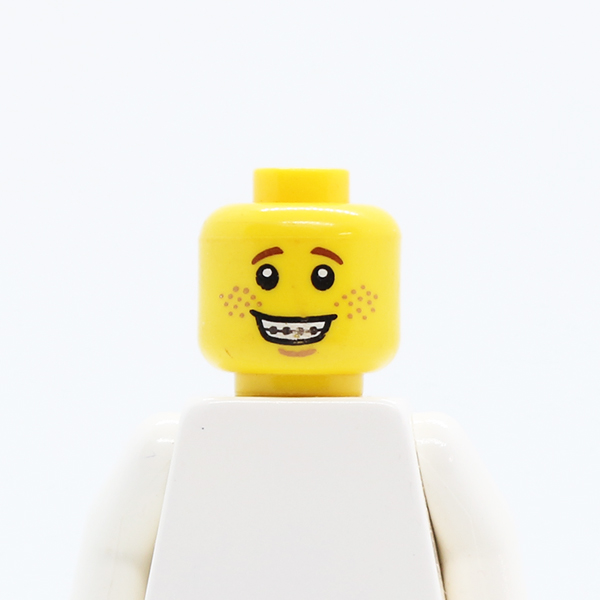 CS12 Open Mouth Smile with Teeth and Braces, Freckles Pattern - Hollow Stud