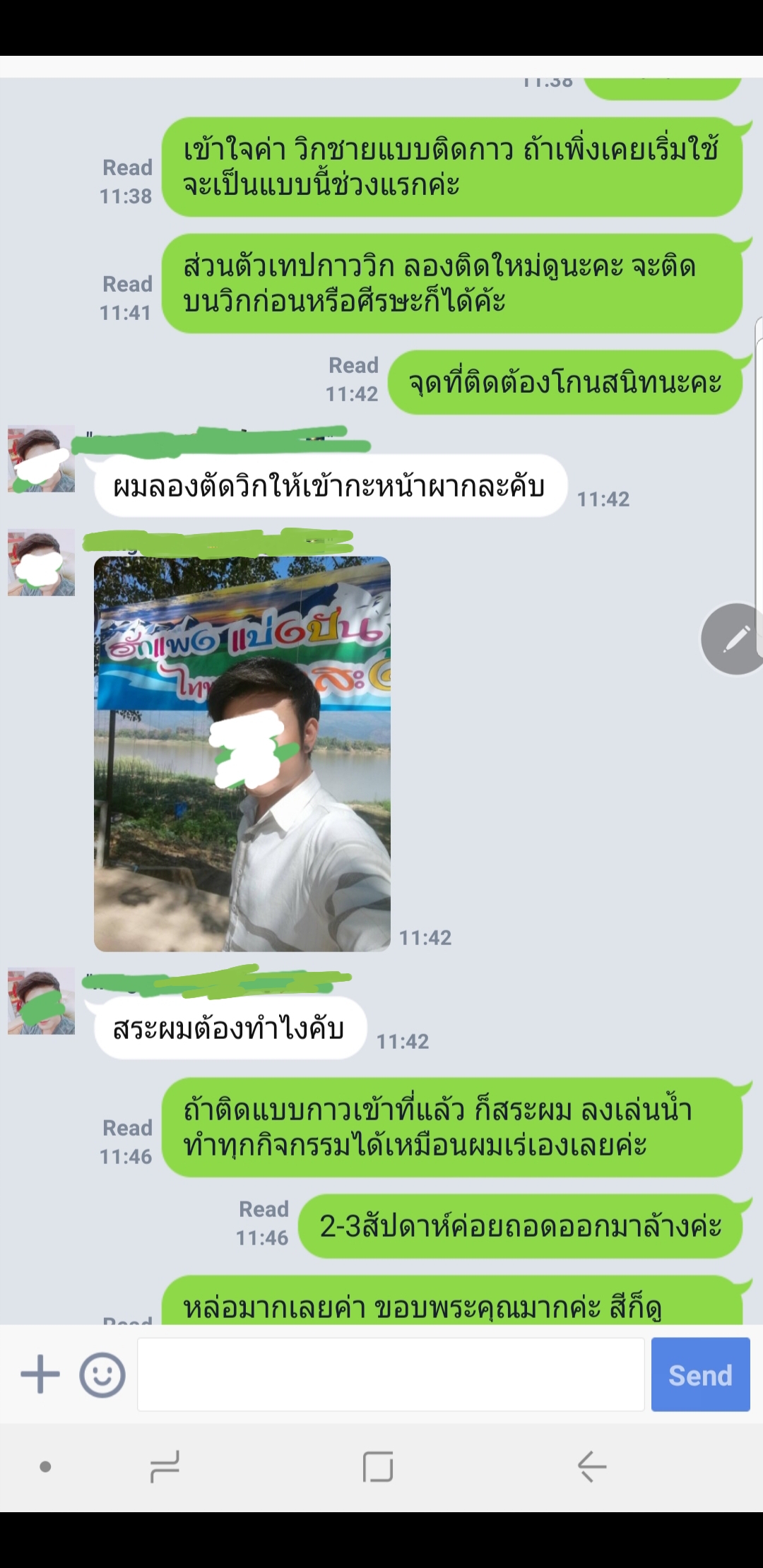 วิกแปะหัวล้าน วิกติดกาว แผ่นแปะหน้าผากสูง วิกปิดหัวเถิกหัวล้านด้านหน้า