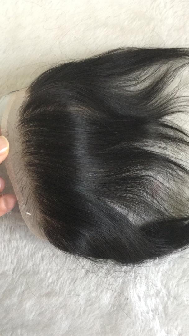 วิกแปะหัวล้าน วิกติดกาว แผ่นแปะหน้าผากสูง วิกปิดหัวเถิกหัวล้านด้านหน้า