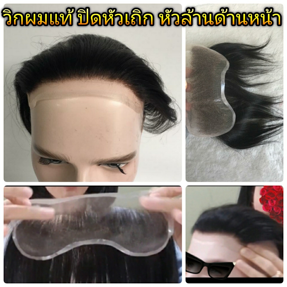 วิกแปะหัวล้าน วิกติดกาว แผ่นแปะหน้าผากสูง วิกปิดหัวเถิกหัวล้านด้านหน้า