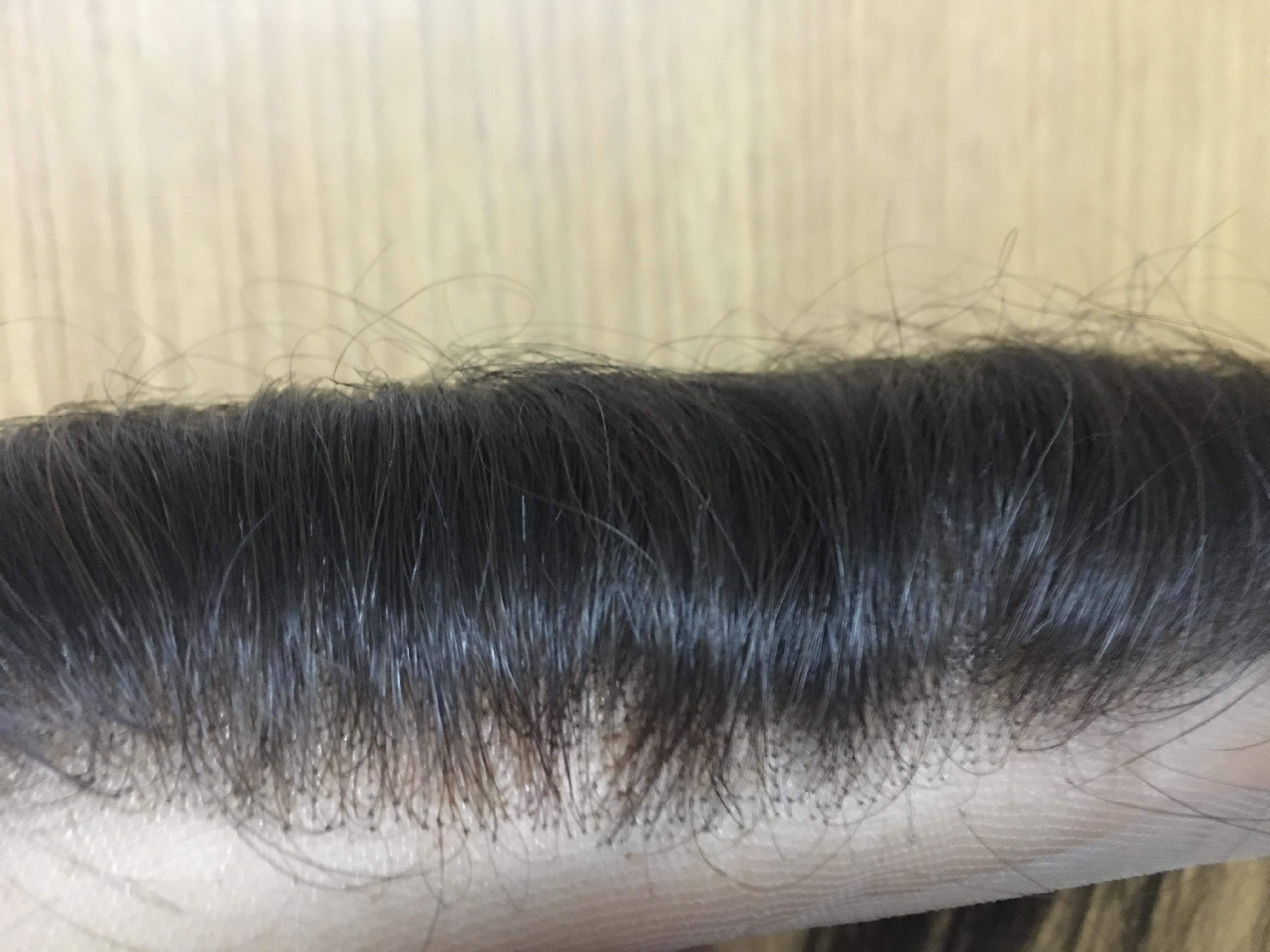 วิกแปะหัวล้าน วิกติดกาว แผ่นแปะหน้าผากสูง วิกปิดหัวเถิกหัวล้านด้านหน้า