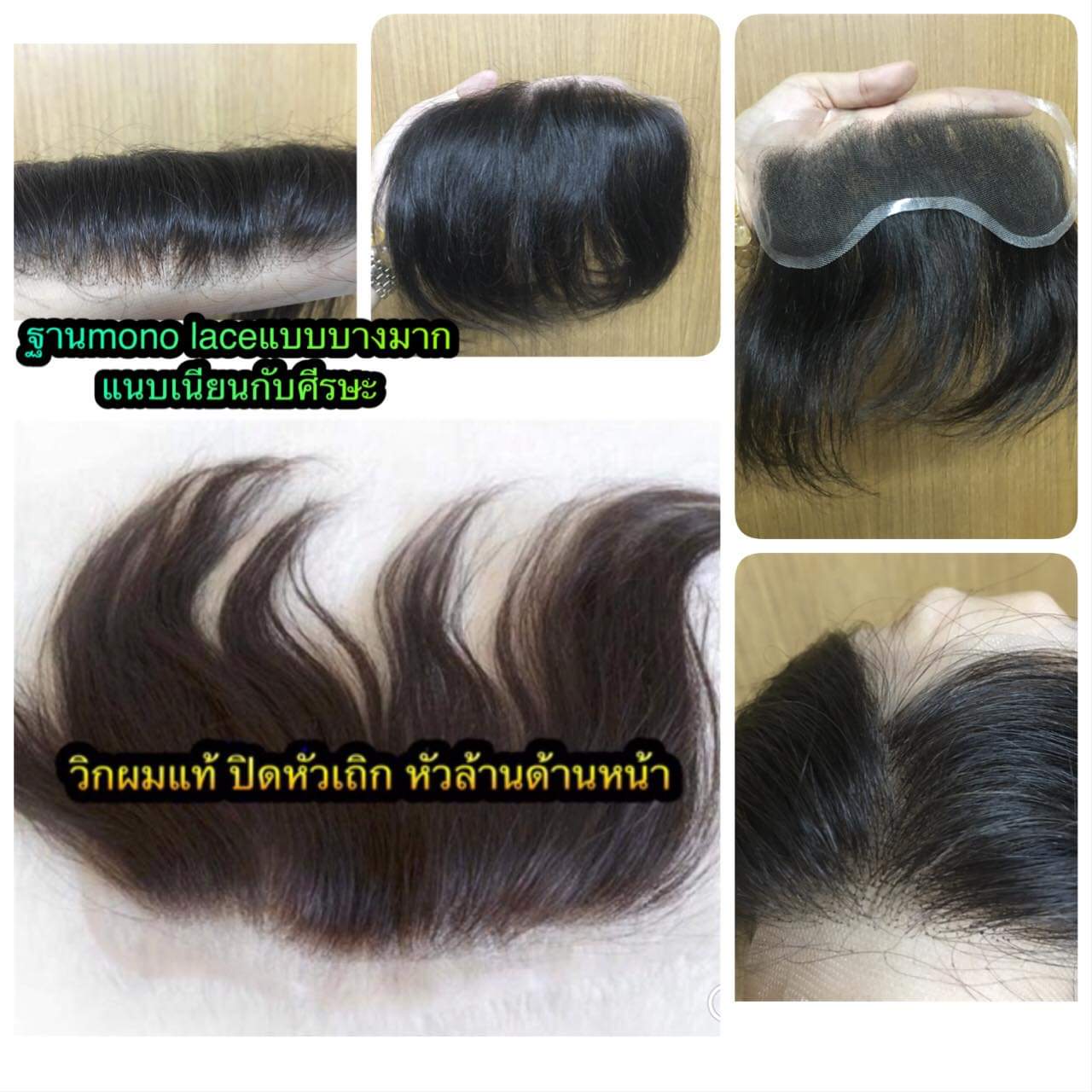 วิกแปะหัวล้าน วิกติดกาว แผ่นแปะหน้าผากสูง วิกปิดหัวเถิกหัวล้านด้านหน้า