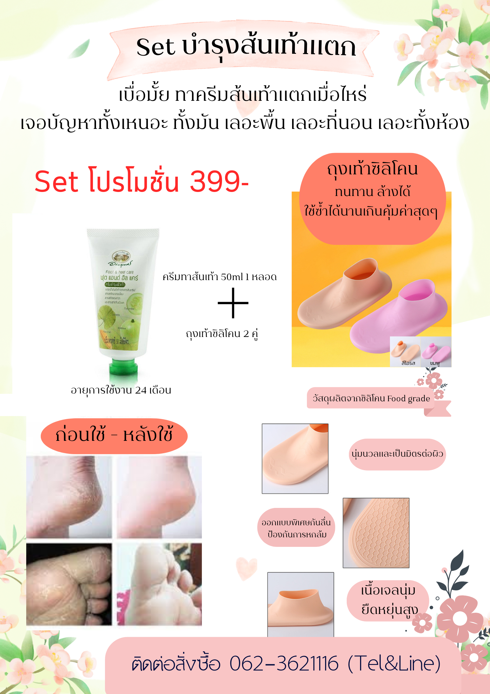 ชุดครีมทาส้นเท้าแตก ราคา 399-