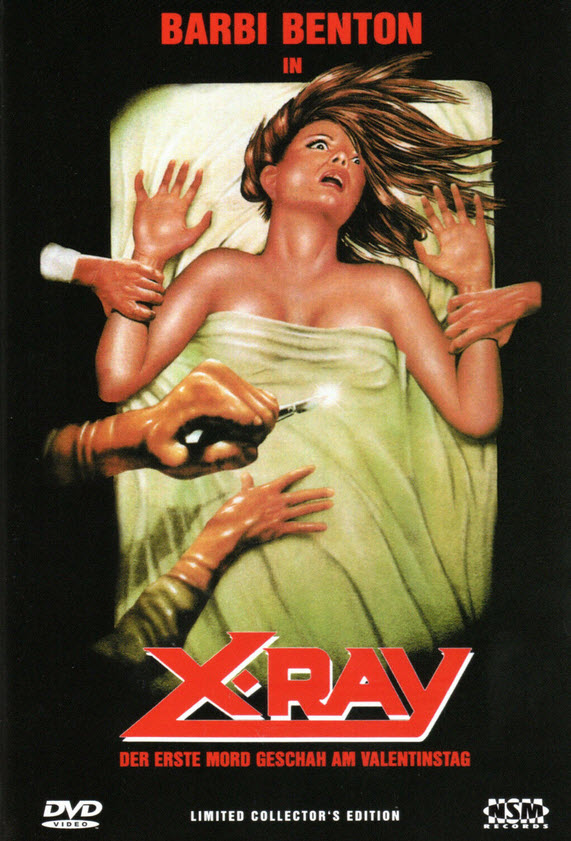 Hospital Massacre (X-Ray) : โรงพยาบาลเชือดอำมหิต [1981] - เสียงอังกฤษ / บรรยายไทย