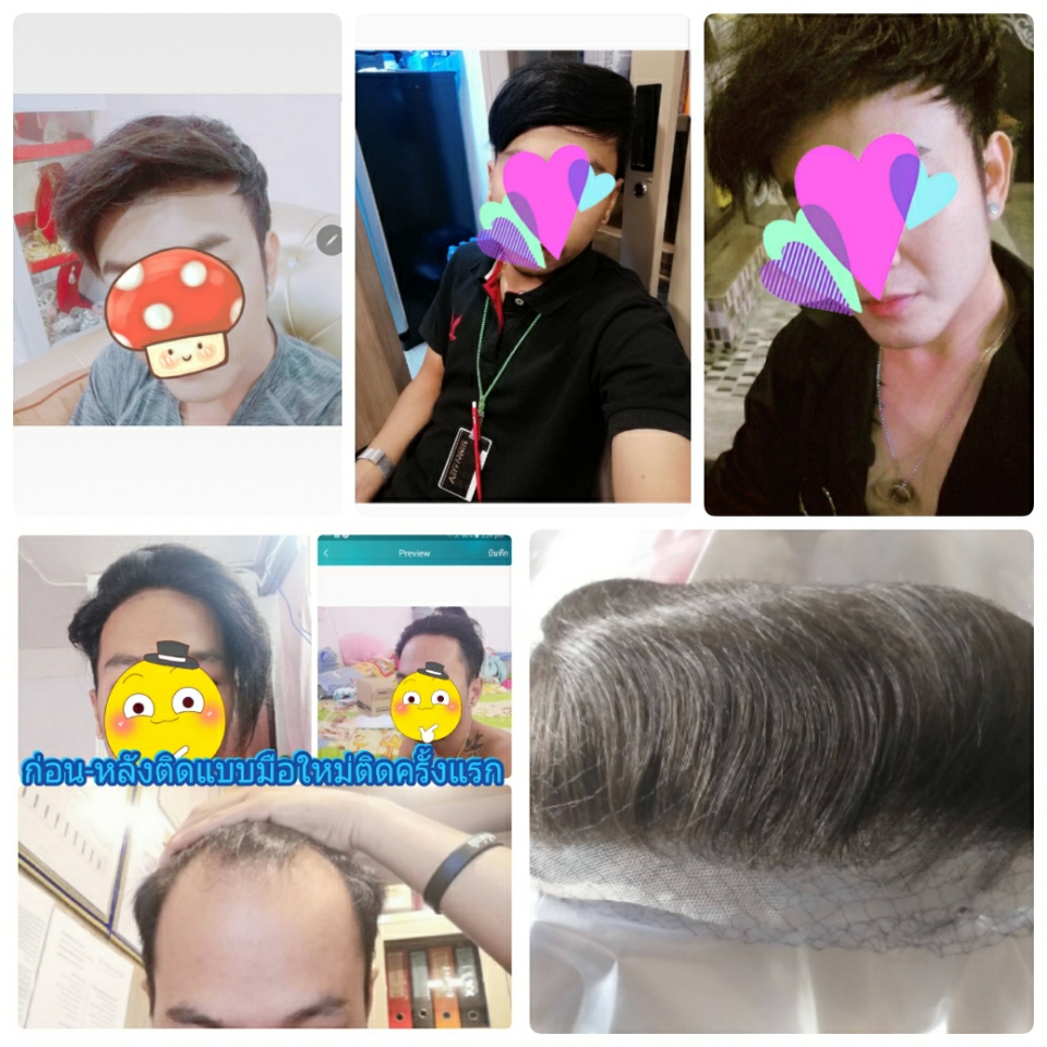 วิกแปะหัวล้าน วิกติดกาว แผ่นแปะหน้าผากสูง วิกปิดหัวเถิกหัวล้านด้านหน้า