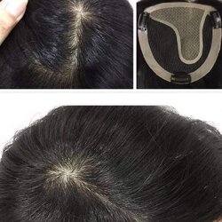 เสริมบาง ผมแท้100% แผ่นปิดผมบางทอมือ มีหนังศีรษะแสกได้ ขนาดฐานใหญ่ 15×15ซม ผมยาว30ซม