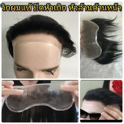 วิกแปะหัวล้าน ติดกาว แผ่นแปะหน้าผากสูง วิกปิดหัวเถิกหัวล้านด้านหน้า